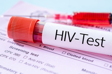 Zelf HIV test uitvoeren
